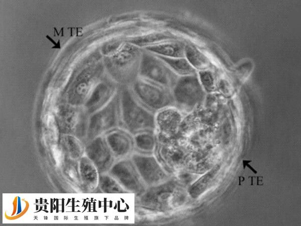 囊胚培养的成功率不仅仅取决于女性