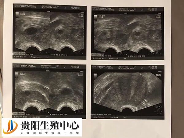 短方案用药时间短