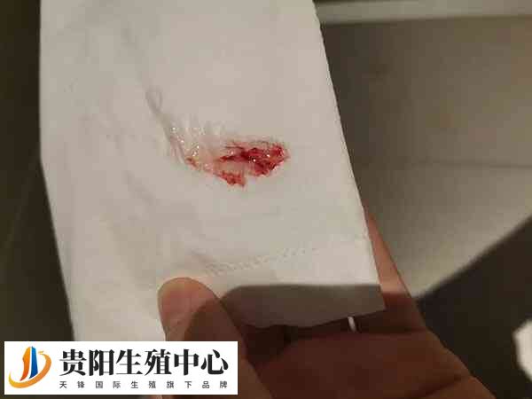 试管移植后出血像量多需考虑着床失败