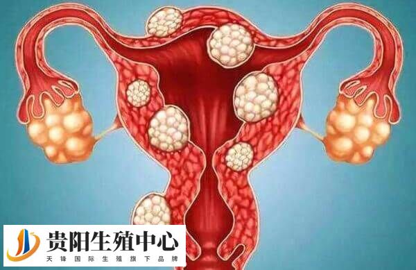 贝依在治疗子宫肌瘤的临床上应用较为广泛