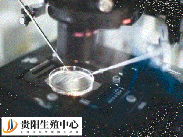 冻胚移植周期最常使用的是自然周期