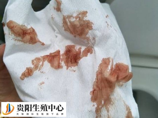 试管移植后孕酮低可能会导致流血