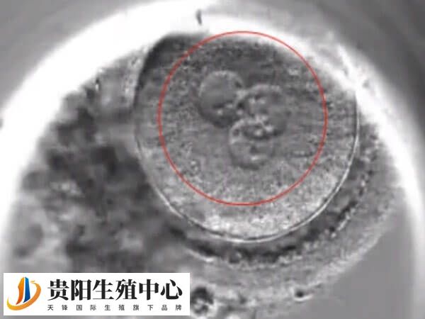 促排激素水平异常会影响卵子质量