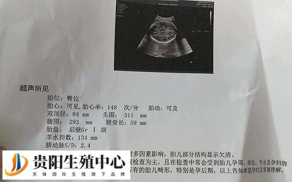 女人做了试管人就废了这个说法是不正确的