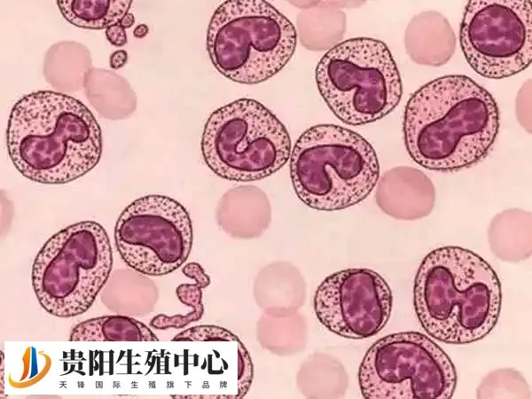 试管婴儿可否筛查掉HLA B-27