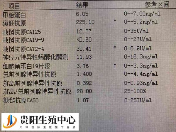 HLA-B27是人类白细胞抗原B27的简称