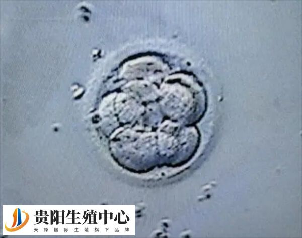 4bb囊胚会不会变成双胎