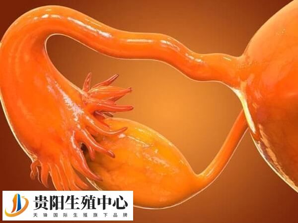 输卵管堵塞要不要做试管婴儿